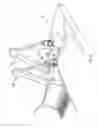 Fig. 37 - Orthovoltage radiotherapy