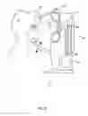 Fig. 02 - Orthovoltage radiotherapy