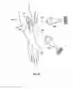 Fig. 44 - Orthovoltage radiotherapy