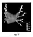 Fig. 02 - Registration of electroanatomical mapping points to corresponding image data