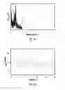 Fig. 04 - List Mode-Based Respiratory and Cardiac Gating in Positron Emission Tomography