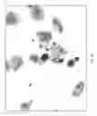 Fig. 15 - METHODS OF CHROMOGEN SEPARATION-BASED IMAGE ANALYSIS