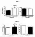 Fig. 02 - USE OF ANTIRESORPTIVE COMPOUNDS TO PREVENT IONIZING RADIATION-INDUCED ACTIVATION OF OSTEOCLASTS AND RESULTING BONE LOSS