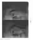 Fig. 08 - Methods for treating skin lines and wrinkles and improving skin quality