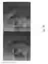 Fig. 09 - Methods for treating skin lines and wrinkles and improving skin quality