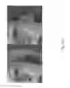 Fig. 19 - Methods for treating skin lines and wrinkles and improving skin quality