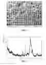 Fig. 02 - Macroporous and highly resorbable apatitic calcium-phosphate cement
