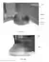 Fig. 09 - Exercise training tool