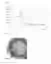 Fig. 02 - Mesoporous silica particles