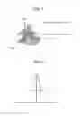 Fig. 02 - Method for erasing image on thermoreversible recording medium