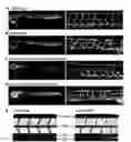 Fig. 01 - Compositions and methods for treating ocular pathologic angiogenesis and vascular permeability