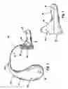 Fig. 02 - Hearing assistance device having reduced mechanical feedback