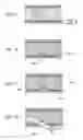 Fig. 08 -  TREATMENT METHOD