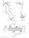 Fig. 04 - Rotate-to-advance catheterization system