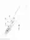 Fig. 40 - Rotate-to-advance catheterization system