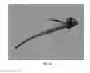 Fig. 44 - Rotate-to-advance catheterization system