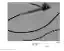 Fig. 46 - Rotate-to-advance catheterization system