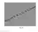 Fig. 47 - Rotate-to-advance catheterization system