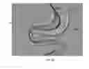 Fig. 48 - Rotate-to-advance catheterization system