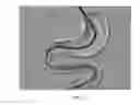 Fig. 49 - Rotate-to-advance catheterization system