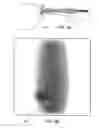 Fig. 06 - SPECTROSCOPICALLY ENHANCED IMAGING