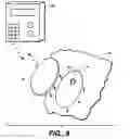 Fig. 06 - Sensor Inserter Assembly