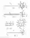 Fig. 02 - ELECTROPHYSIOLOGY CATHETER WITH ELECTRODE LOOP