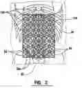 Fig. 04 - EMG electrode apparatus and positioning system
