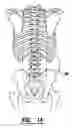 Fig. 09 - EMG electrode apparatus and positioning system