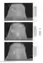 Fig. 09 - Systems and methods for tracking and targeting object in a patient using imaging techniques