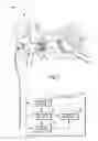 Fig. 02 - ULTRASONIC DETECTION OF EAR DISORDERS