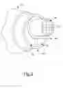 Fig. 03 - ULTRASONIC DETECTION OF EAR DISORDERS
