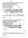 Fig. 06 - METHODS AND APPARATUS FOR ANALYZING AND LOCALLY TREATING A BODY LUMEN