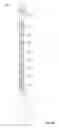 Fig. 06 - Urological medical device and method for analyzing urethral properties