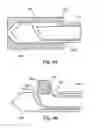 Fig. 06 - INTEGRATED BONE BIOPSY AND THERAPY APPARATUS