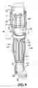 Fig. 06 - Composite plastic rigid walking cast with cushioned interior supports