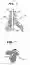 Fig. 41 - Devices and Methods for Interstitial Injection of Biologic Agents into Tissue