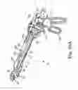 Fig. 43 - Devices and Methods for Interstitial Injection of Biologic Agents into Tissue
