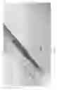 Fig. 04 - Clog-preventing valved catheter and method of using the catheter