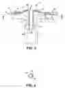 Fig. 03 - Seal for an ostomy appliance