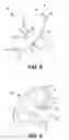 Fig. 07 - Seal for an ostomy appliance