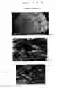 Fig. 02 - ABSORBENT ARTICLE WITH A STRONGLY HYDROPHOBIC LAYER
