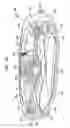 Fig. 24 - Variable flow infusion pump system