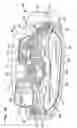 Fig. 27 - Variable flow infusion pump system