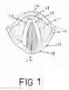 Fig. 02 - Technique to enhance voice with Laser beam