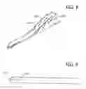 Fig. 09 - Saw for the removal of a prosthesis
