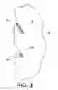 Fig. 03 - ORAL CLEANING DEVICE