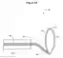 Fig. 05 - DEVICES AND METHODS FOR LIGATING ANATOMICAL STRUCTURES