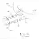 Fig. 20 - DEVICES AND METHODS FOR LIGATING ANATOMICAL STRUCTURES