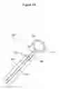Fig. 24 - DEVICES AND METHODS FOR LIGATING ANATOMICAL STRUCTURES